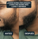 ¡SOLO HOY!🔥     ¡SUPEROFERTA!      BUNEE - Camuflagle capilar 🔥 ¡COMPRA 2 PRODUCTOS Y OBTÉN UN SÚPER DESCUENTO! 🔥