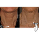 🚨 OFERTA ESPECIAL VÁLIDA SOLO HOY - Masajeador Facial Rejuvenecedor Luz Led