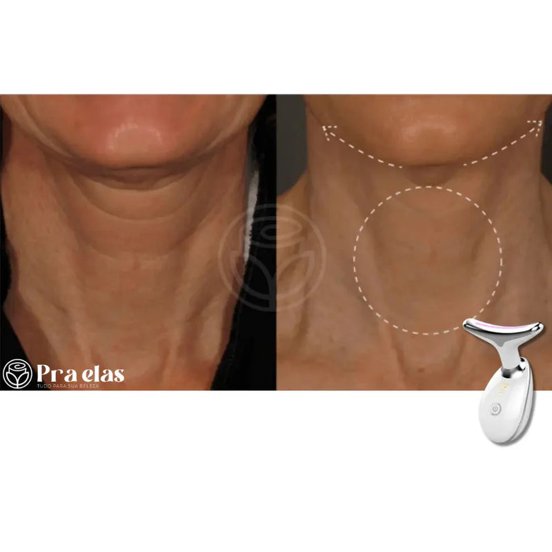 Masajeador e Tonificador Facial Quita Papada